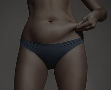liposuction Sydney